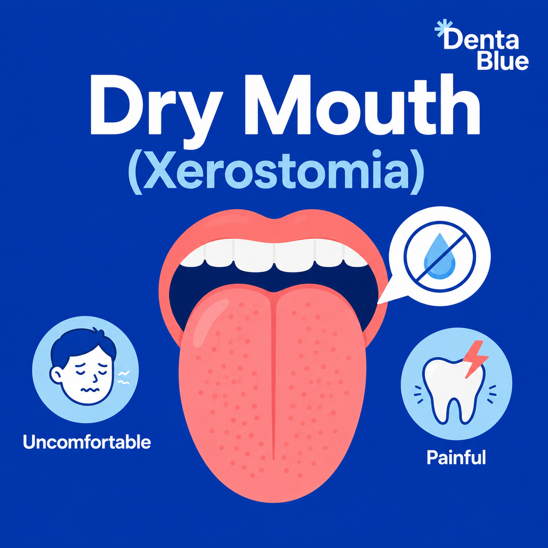 What is Dry Mouth (Xerostomia)?